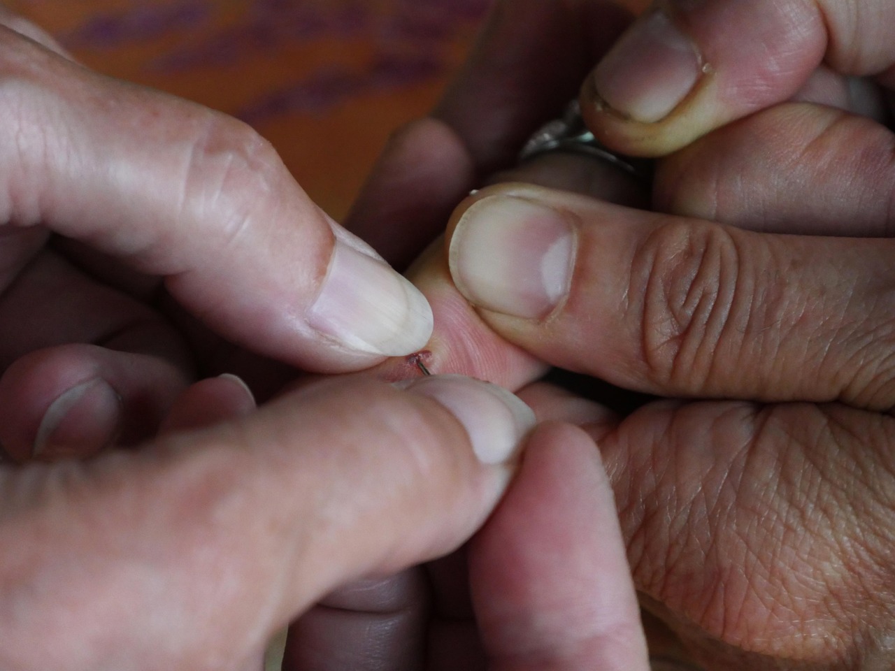 Wound Care and Management