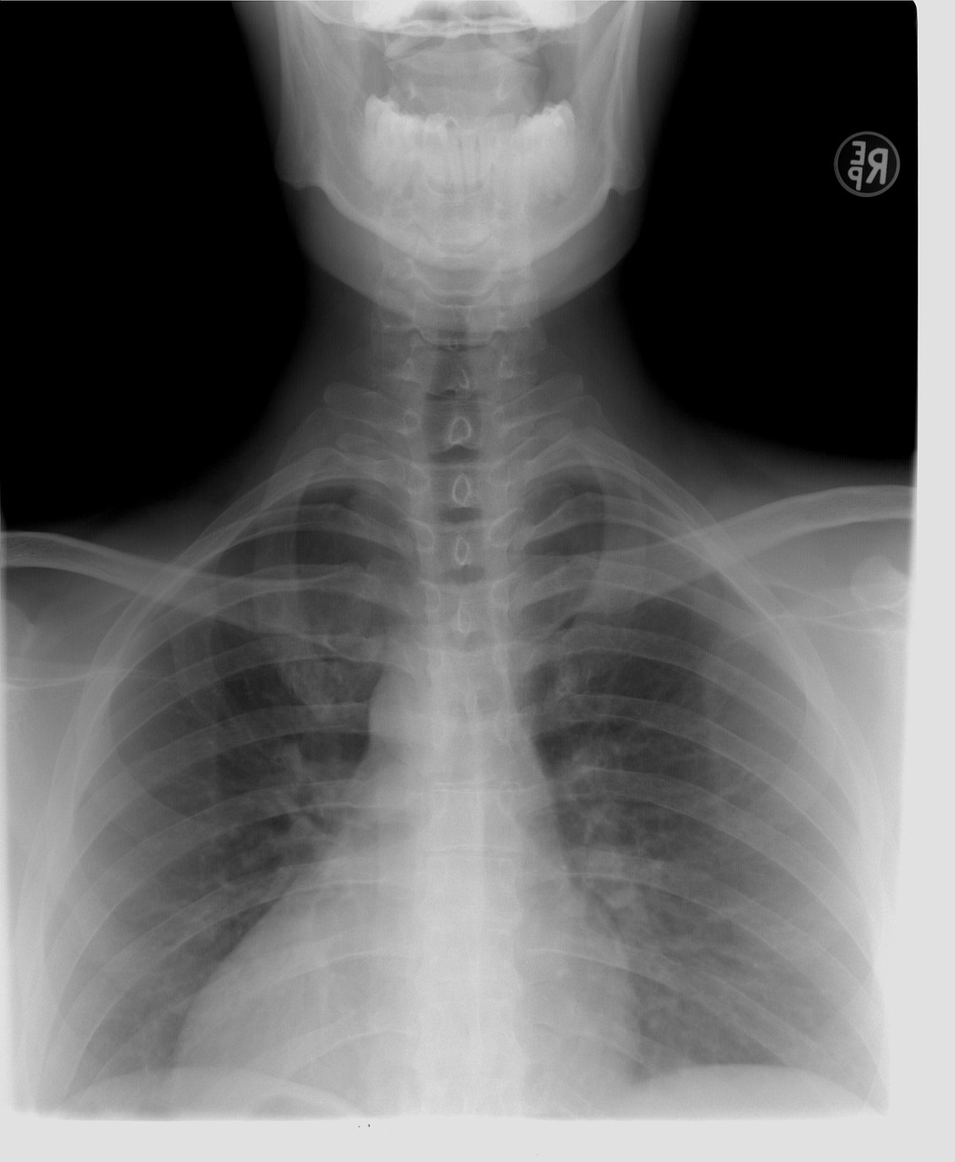 Diagnostic Imaging in Vascular Care
