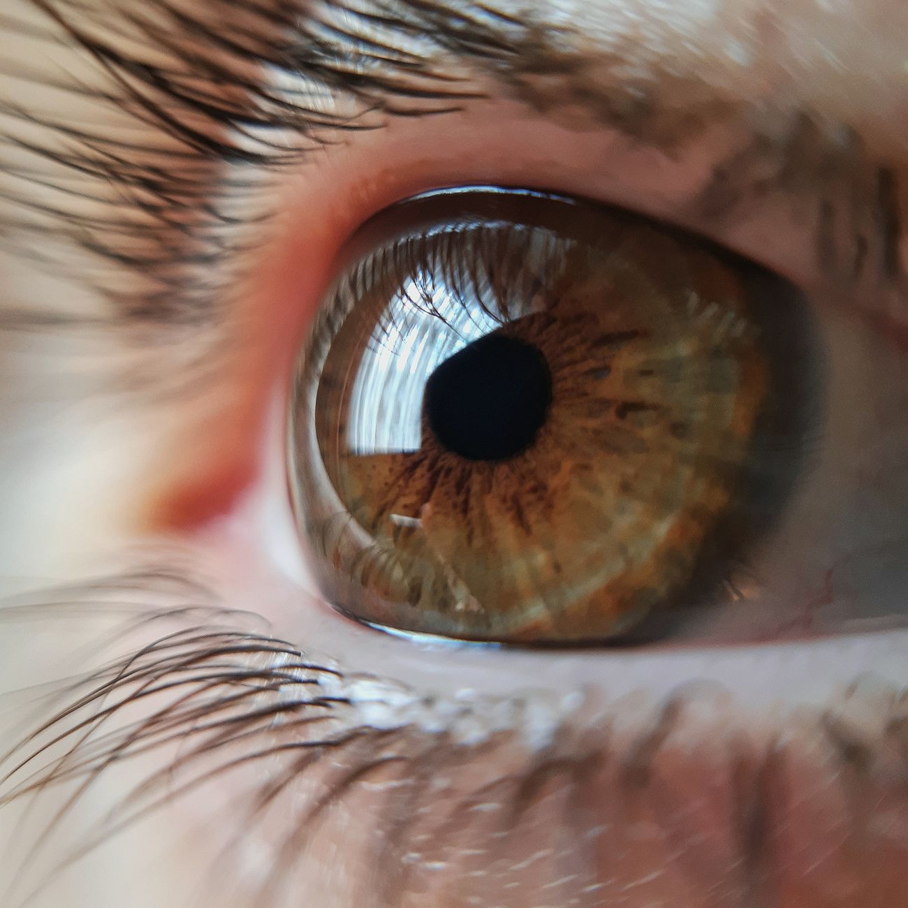 Complications and Prognosis of Ocular Tumors