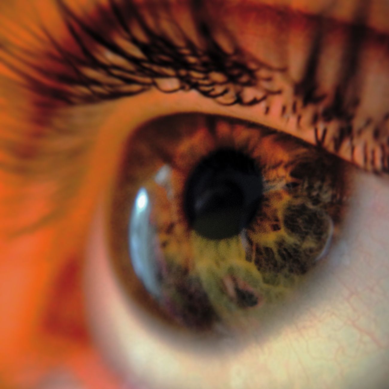 Introduction to Strabismus and Amblyopia