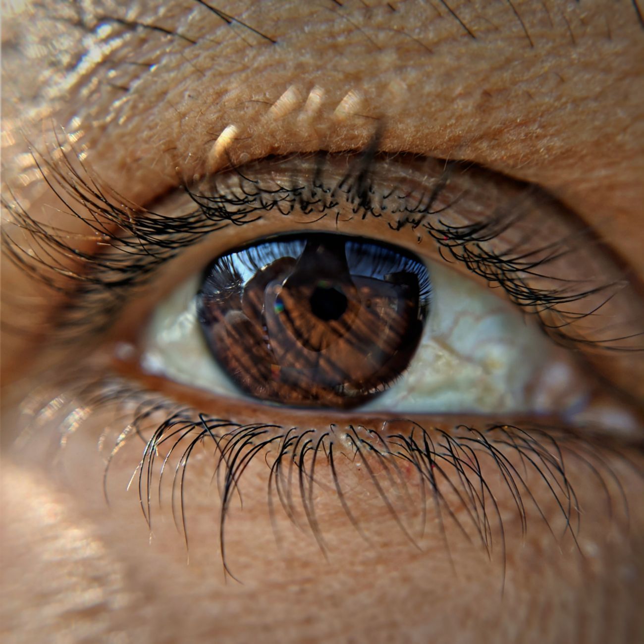 Applications of AI in Vision Correction