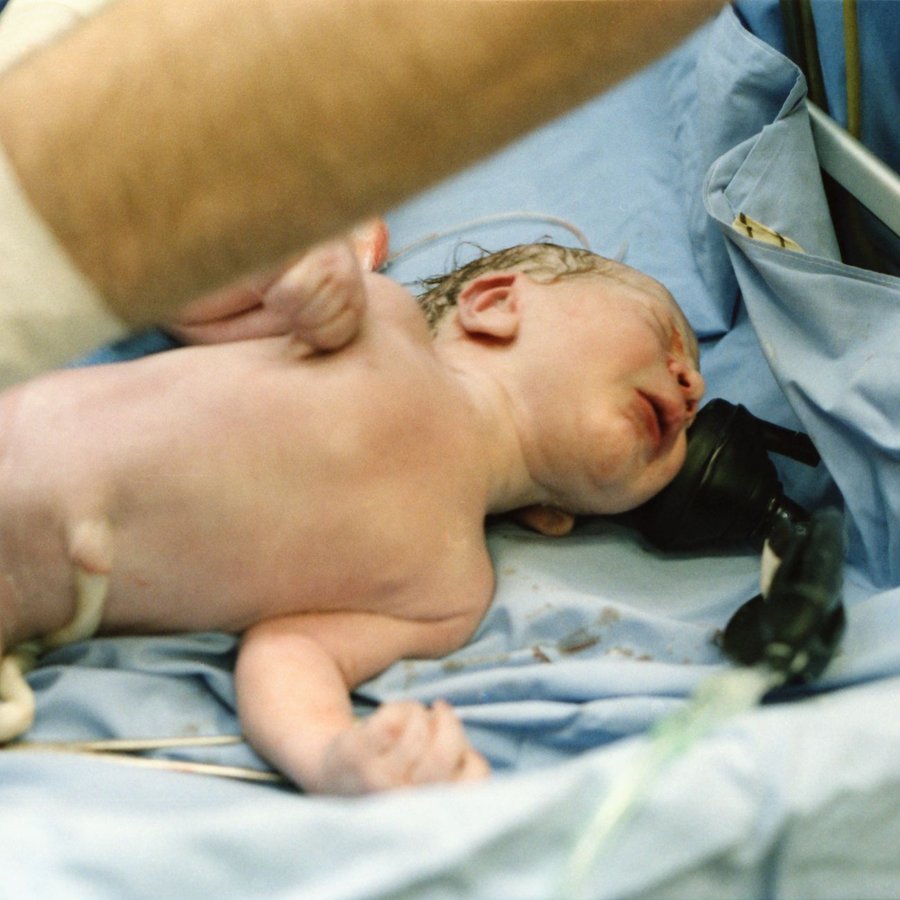 Advanced Technologies in Neonatal Medicine