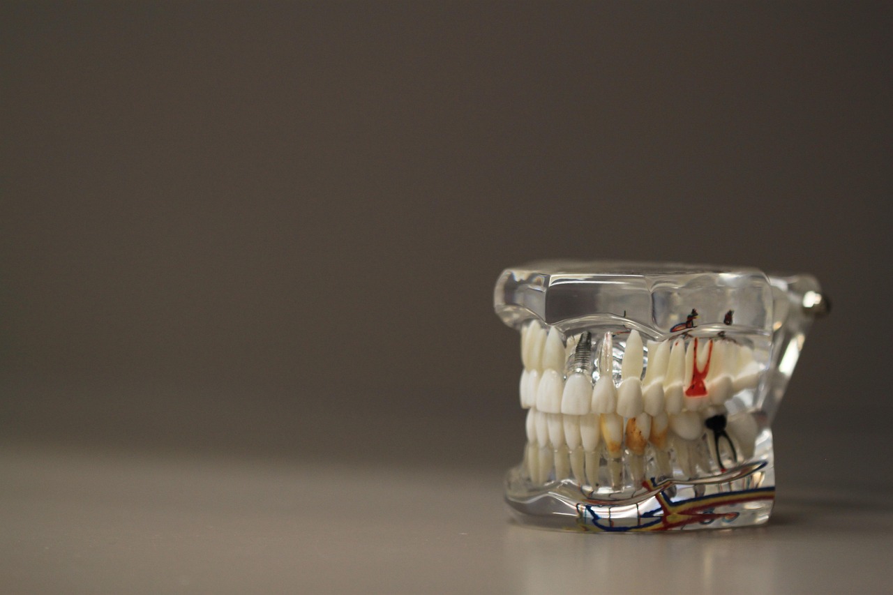 Oral Health Promotion and Disease Prevention