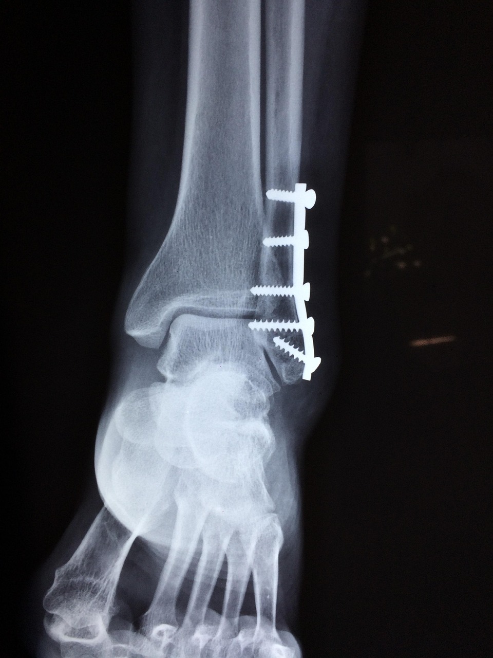 Pain Management